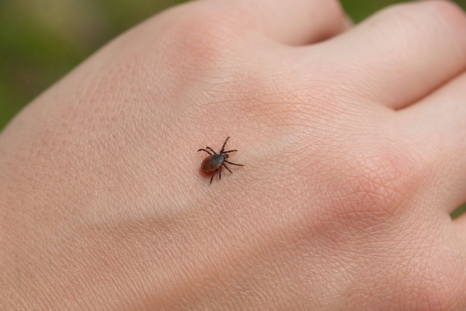 Erzincan’da Bahar Aylarıyla Birlikte Kene Riskine Karşı Uyarılar Artıyor